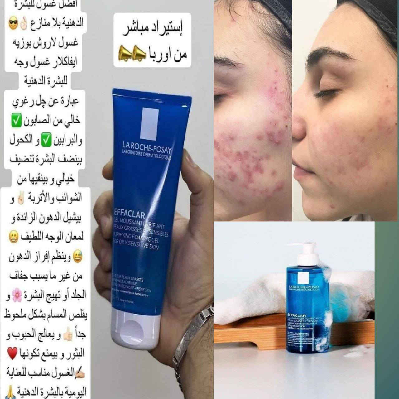 منتجات اصليه ومجربه للطلب والستفسار مراسلة الصفحة


**إذا كنت صاحب هذا الإعلان وتريد حذفه لأي سبب، رجاءا أرسل رسالة إلى الدعم الفني**