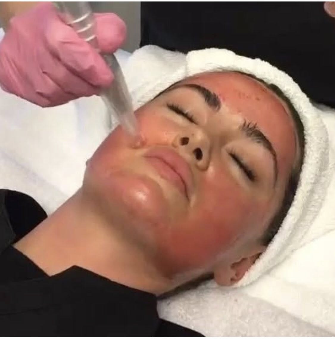 احصلي على بشرة ناعمة ومتجددة مع جلسات الديرمابن

هل تبحثين عن حل فعال لتجديد بشرتك والتخلص من الندوب والتجاعيد؟ جربي الآن جلسات الديرمابن لدينا واستمتعي ببشرة أكثر نضارة وشباباً!

مميزات الديرمابن

تحفيز إنتاج الكولاجين والإيلاستين

تحسین مظهر الندوب وآثار حب الشباب

تقليل التجاعيد والخطوط الدقيقة

توحيد لون البشرة والتخلص من التصبغات

تحسین ملمس البشرة وجعلها أكثر نعومة

احجزي جلستك الآن واستفيدي من عرض خاص لفترة محدودة
عنوان العيادة عيادة الدكتورة لمياء ميسر شمران

للحجز والاستفسار : [***********]

موقعنا : [هيت / شارع السكلات]
مجمع الملاك الطبي 

احصلي على بشرة الأحلام مع أحدث تقنيات تجديد البشرة. نحن

في انتظارك

#عناية_بالبشرة

#جلدية #عناية

#صحة_تجميل

#ليزر

#علاج_الامراض_الجلدية

#عناية_بالبشرة_والشعر

#ديرمابن

الانبار #هیت

#

بشرة_نضارة

#ديرمابن_علاج_مسامات_علاج_تصبغات_شد

#بلازما

#بلازما_الشعر

بشرة نضارة تفتيح

#بلازما_البشرة
