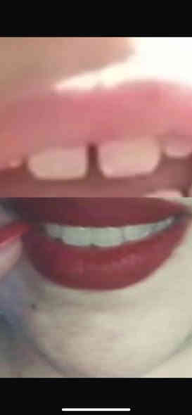 الى الاهالي الكرام ♥️

نود اعلامكم عن افتتاح عيادة طب وجراحة الاسنان
داخل مجمع الزيتون الطبي 

الدكتورة/سميرة مهدي جاسم 
-تنظيف وتبييض الاسنان 
-قلع الاسنان
-حشوات عادية وتجميلية وجذور 
-جسور المتحركة والدائمية 
-علاج اسنان الاطفال 

حسب الاوقات التالية :من الساعة الرابعه عصراً وحتى الثامنة مساءاً (٤-٨)
موقع العيادة:مجمع الزيتون الطبي /هور رجب مقابل افران الزيتون 
للاستفسار الاتصال على الهاتف ***********

(ابتسامتك هي سر جمالك) 

تنورونا ♥️
