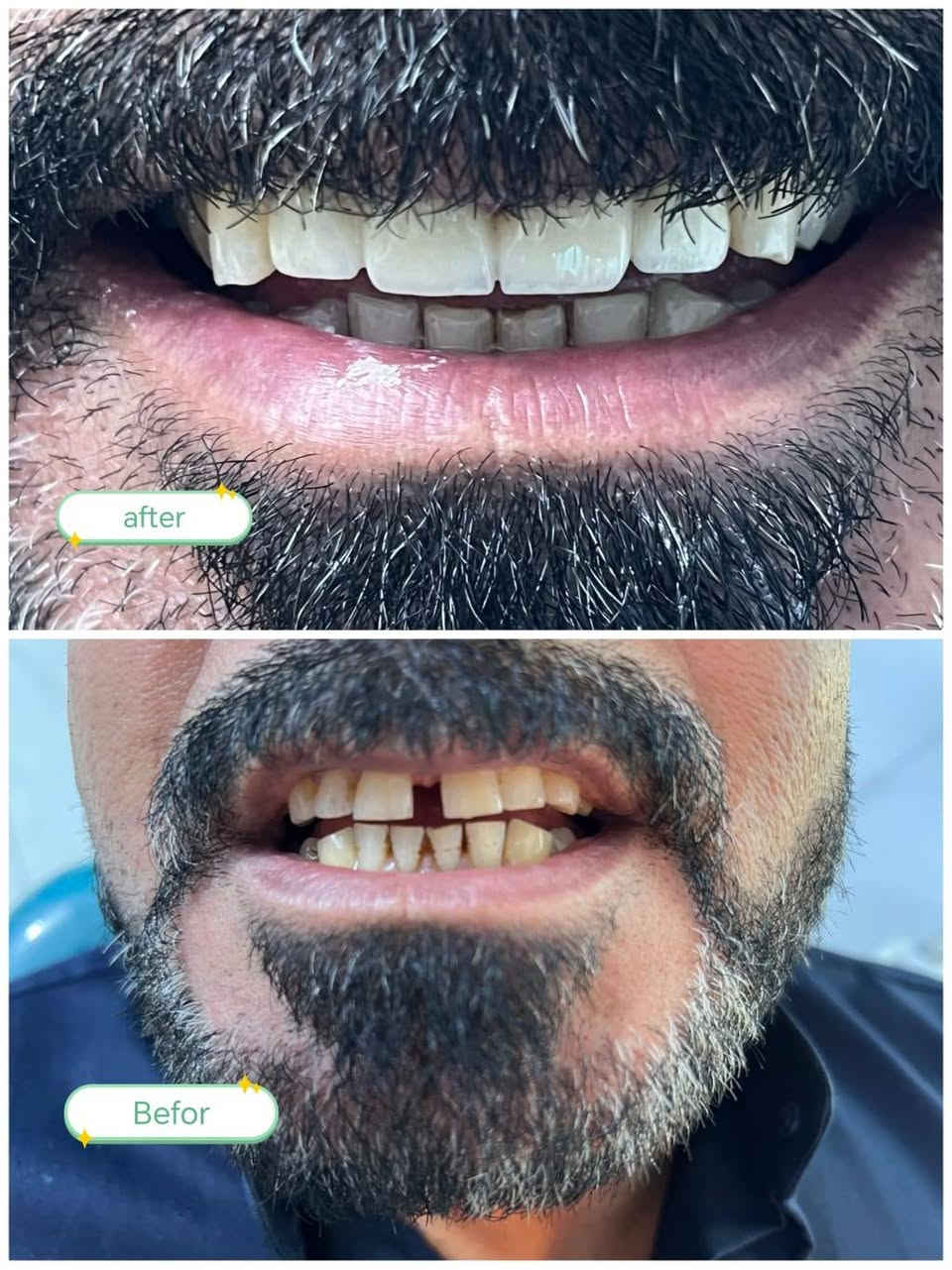 تخفيضات على جميع انواع الاختصاصات كوادر طبيه عالية الكفائه وباسعار مناسبة ومخفضه جدا 
الاسنان كادر رجالي نسائي حشواة تقويم زراعه تجميل 
نسائية جراحه عامه وناظوريه باطنيه واطفال مفاصل وكسور جراحه تجميله نحت تجميل انف قص اجفان 
الامين الثانيه جامع الرسول مجاور ثانوية النور الاهليه الفلكه المشجره


**إذا كنت صاحب هذا الإعلان وتريد حذفه لأي سبب، رجاءا أرسل رسالة إلى الدعم الفني**