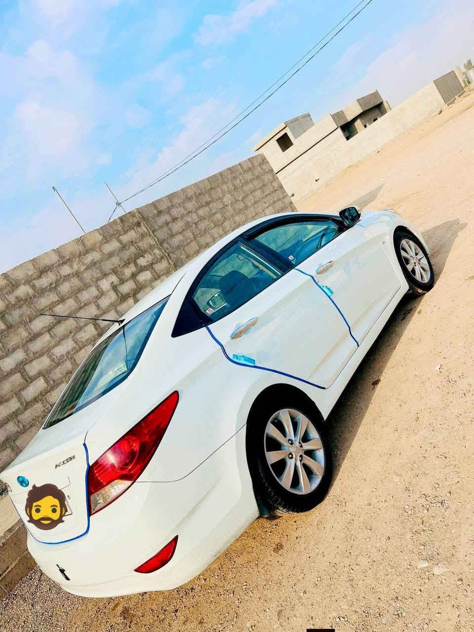 اكسنت   ،،،،،،،،  2011  ***. خلیجی

                                                108   $              

     📞 ***********

موديل:٢٠١١ 
مواصفات : خليجي 
- شاشه
-كاميرا
-خمس ويل كب 
-حساسات 
خلفي
-مرايات كهربائية 
-جامات كهرباء 
-
-٢شريكة 
-
-سياره : 
* بي بل دوسه سكن
 صبغ شبر
 ب جم مكان بارد
يطلع ساتيم

* بدون دعم
* بدون دواخل
* بدون ايرباك 
* بدون ايشي 
شرط 
-كير محرك: مامفتوح
لوك
-

كهربائية ع شريكة
-رقم سليمانية 
دولي
-هززه وبراد 
كله جديد
سنويه جديد 
لحد 2028
-كابون بانزين 
-سياره لوك 

سعر :   108 
مكان : كركوك

رقم :
***********
