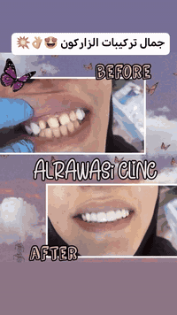 مع كل ابتسامة، نصنعها بكل حب  تتأكد ان اختيارك عياده الرواسي هو القرار الافضل ✨🦷

للحجز والاستفسار الاتصال  ***********

📍العنوان الدولعي داخل سوق الدولعي ثاني فرع ع اليمين
