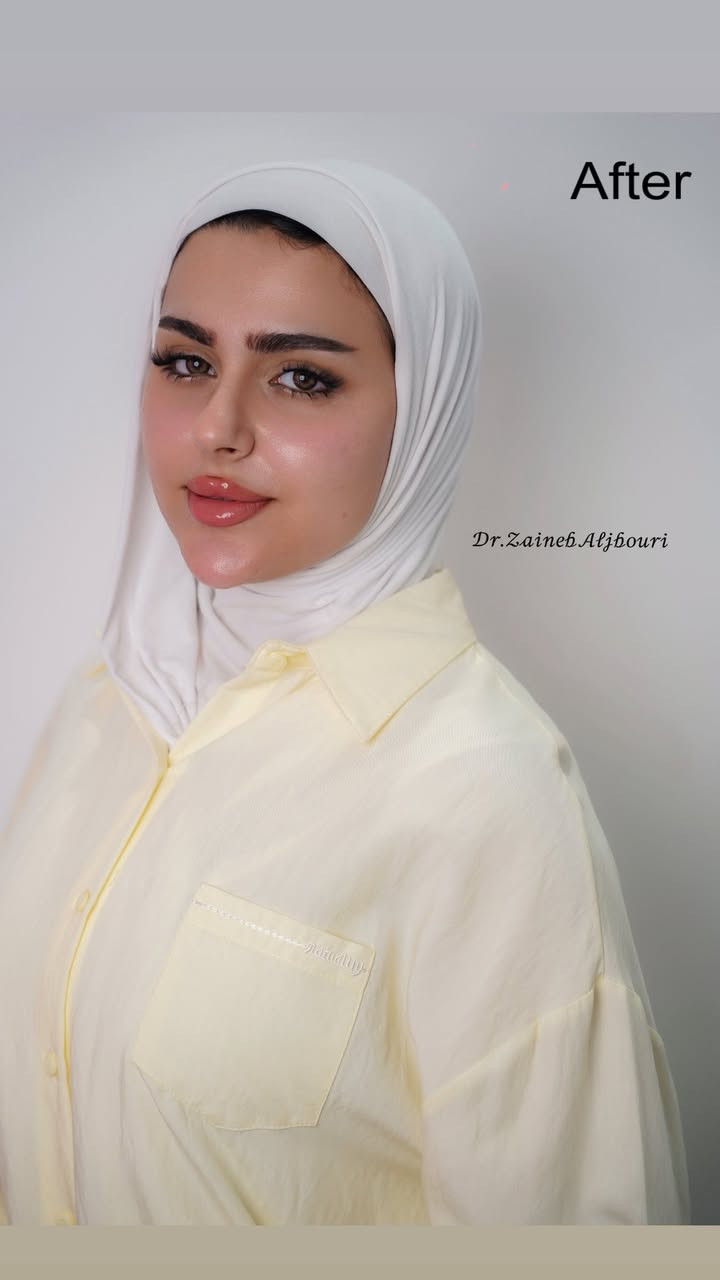 هلو بنات عندي عروض تجنن للعيد تابعوني انستا dr_zaineb_m والتواصل ع الرقم *********** 💗
