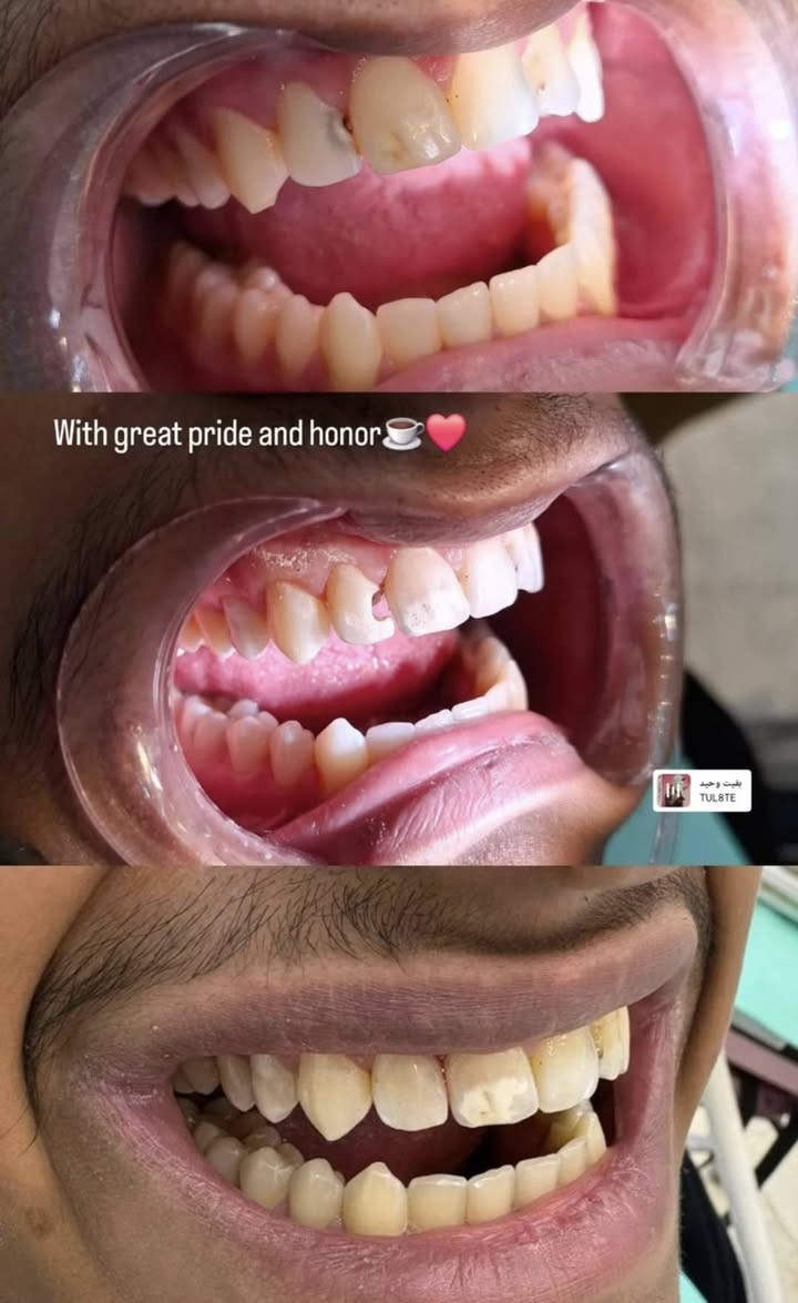 السلام عليكم
عيادة رينيو لطب وتجميل الاسنان
 بإشراف دكتورة كربلاء الاسدي بكلوريوس طب جامعه بغداد سرتفكيت فى التجميل اللاجراحي
للحجز: ***********
العنوان: بغداد مدينه الصدر قطاع 14 مقابل صورة السيـد .
