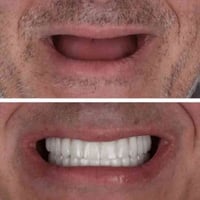 علاج اسنان • طقم اسنان • مستشفى جامعة الكوفة