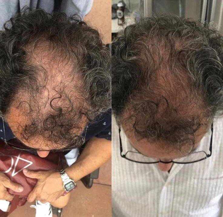 حلمكم حقيقة


**إذا كنت صاحب هذا الإعلان وتريد حذفه لأي سبب، رجاءا أرسل رسالة إلى الدعم الفني**