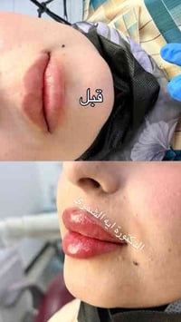 مسابقة التجميل • تغير شامل • الديوانية