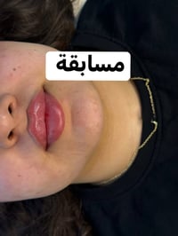 مسابقة فيلر • تغيير شامل • خانقين