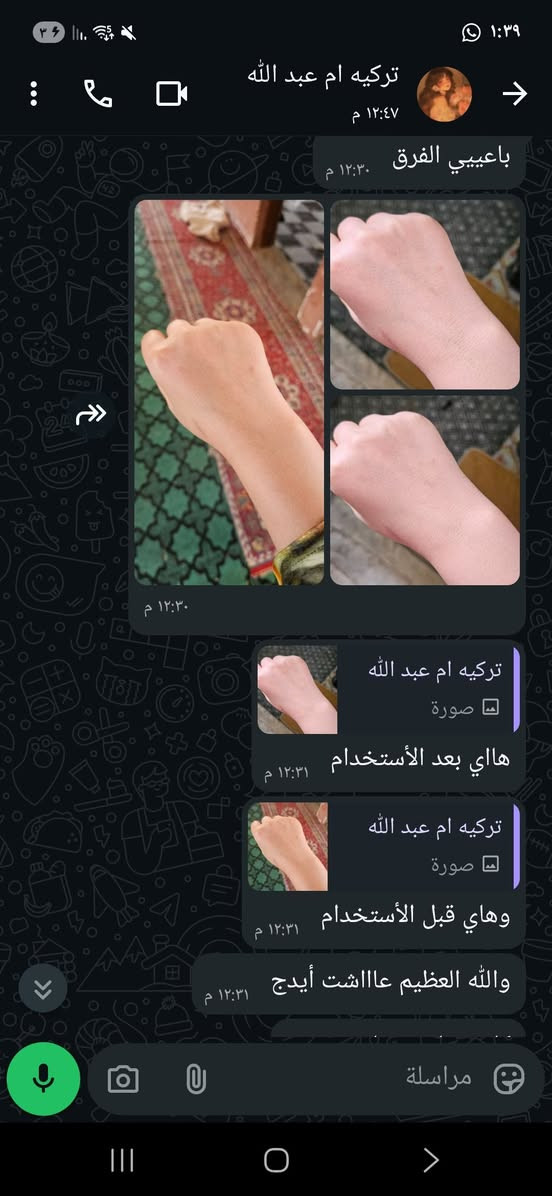 مقشرات جسم مواد طبيعي حجم ٢٥٠ مل سعر ٨وخلطه قدم سعر ٥٠ مل ب٦


**إذا كنت صاحب هذا الإعلان وتريد حذفه لأي سبب، رجاءا أرسل رسالة إلى الدعم الفني**