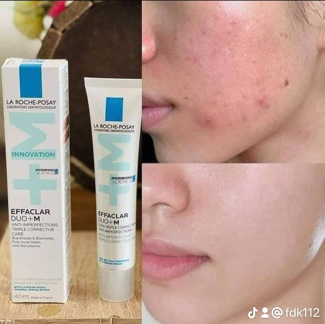 سيروامات اخر قطع فرنسي  اصلي باركود الي تريدهم شلعه تدخل  خاص وتدلل


**إذا كنت صاحب هذا الإعلان وتريد حذفه لأي سبب، رجاءا أرسل رسالة إلى الدعم الفني**