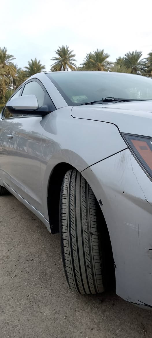 السلام عليكم
النترا 2019 وارد امريكي مكينة 2000دوش 
نص فول كامرا وشاشة تحكم ستيرن  نضام سبورت ماشية 45 الف كير ومكينة مكفولات
ضرر جاملغ خلفي رقم ديالى الجديد مكان ديالى ناحية كنعان السعر 150
الرقم *********** غير متواجد ع الفيس
