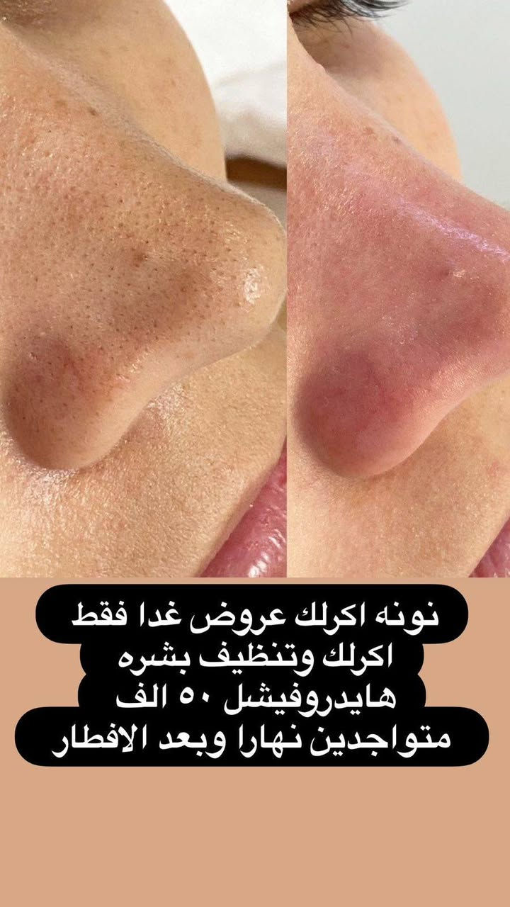 اكرلك 💅 💜
العنوان الخاجيه شارع 40 داخل السوق لعصري 💅🫶 حبايبي اسم مالتنه نونه اكرلك ماعدنه غير فرع 
***********
