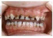 السلام عليكم
علاج أسنان مجاناً (حشوات ضوئية للكبار والصغار // تنظيف اسنان // قلع جذور الأسنان المتبقية // طقم اسنان كامل متحرك // تقويم اسنان للاطفال(6-12سنة)

🔘عيادات جامعة ابن سينا
🔘بغداد القادسية قرب محطة تعبئة البياع الحكومي
🔘التواصل ***********
