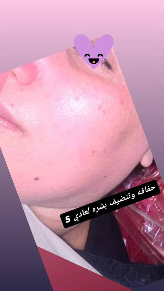 حفافه وتنضيف بشره 5
بدكير للقدام 10
اي ستفسار راسلوني واتساب
*********** عمارة, ميسان
