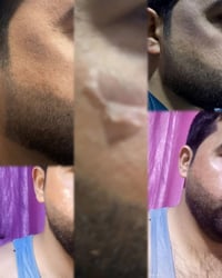 تابعونا وشوفو عروض عيادتنا 💉❤07854772091بغداد / الدورة/ شرطة ابو طيارة...