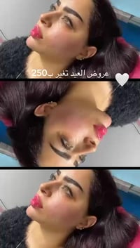 فلر شفه • فلر ذقن • كربلاء الجمعية