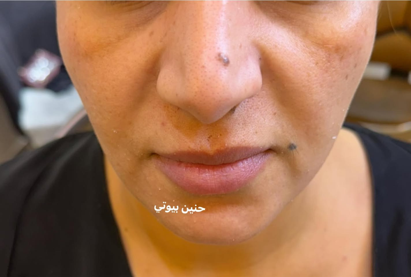 حنين بيوتي 🍒مصنع الحلويات 🍒


**إذا كنت صاحب هذا الإعلان وتريد حذفه لأي سبب، رجاءا أرسل رسالة إلى الدعم الفني**