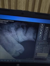 منشور للفائده  الي عنده جذور تالفة او اسنان تعبانه، سن العقل المطمور  ...