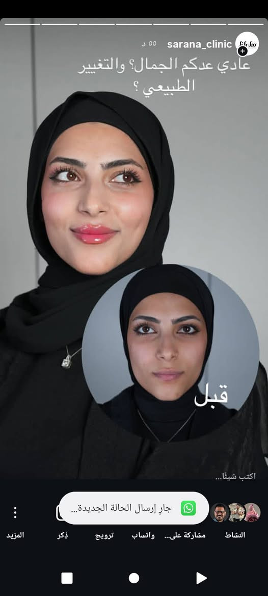 عنواننا النجف ركن السلام جامعه(الاربع شوارع) مجاور ازبري قرب يو كافيه
https://www.instagram.com/reel/DVoo2aKjQVT/?igsh=Mzd2cjQydXVzMXRiللحجز ***********
