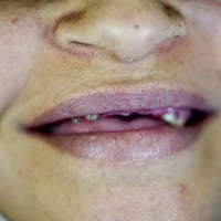 ابتسم دائماً ❤️ الشغل الصح ✅ بالمكان الصح✅🫡  (زراعة-تقويم-تغليف-تركيب)...