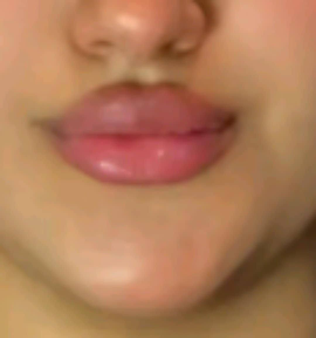 عروض الفلر نوعيته كلو بلاص الفرنسي ،والايطالي السيسي 50البلازمه المفعله بي اربي 30الجلسه والبوتوكس الكندي 40 وتغير وجه كامل  بلفلر  250 والغمازه 25 والبرنسك 25باختصاص دكتورة بنات هاي عروض بصالون الانيقه ***********
