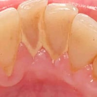 اللي محتاج تنظيف مجاني يتواصل ويايه واتساب 07849832584 جامعة الهادي نه...