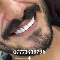 ابتسامة هوليود • بدون برد • عيادة هند الحسيني