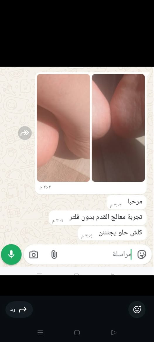 لا تقصرون برفع الصفحه متعطله ❤️
بنات بس ب5 الف عافيه تخلين قدمج يضوي مرجوع فقط من أول استعمال يجنننن بالصيف اكيد تشققات وخشونه شرط مليان زيوت عشبيه وزبدات وكريمات مغذيه ترمم جلد من الداخل وتسوي القدم ناعممم وردي خفيف وحت من فوك ينطي تفتيح ويسوي الاضافر وردي عبالك بيبي حجم كبير يكفيج شهرين


**إذا كنت صاحب هذا الإعلان وتريد حذفه لأي سبب، رجاءا أرسل رسالة إلى الدعم الفني**