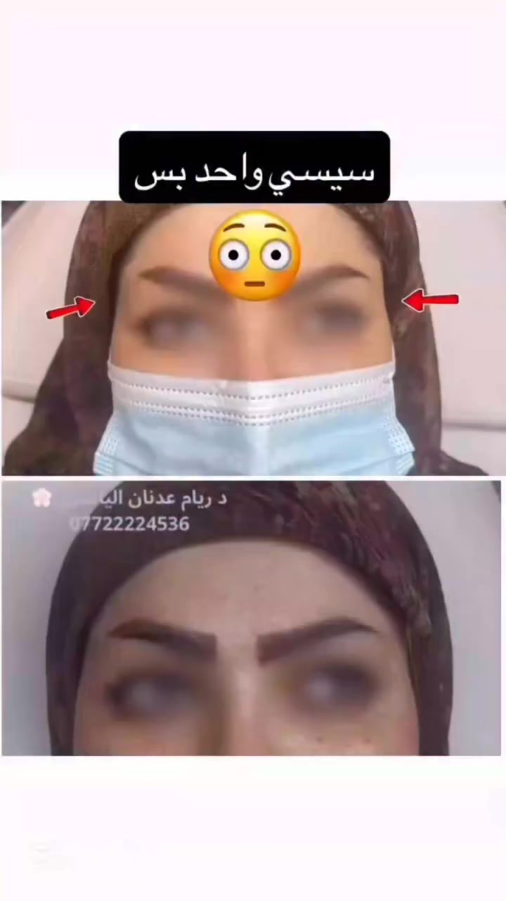 ✨ لأن صحتك وجمالك يستاهلون الأفضل ✨
تقدم لكم عيادة [الضياء سمايل]
أفضل الخدمات الطبية والتجميلية بأحدث الأجهزة وعلى أيدي مختصين 💉🌸
✔️ استشارات طبية دقيقة
✔️ جلسات تجميل وعناية بالأسنان
✔️ نتائج مضمونة واهتمام بأدق التفاصيل
📍 الموقع: [السماوه حي المعلمين مقابل نيكست لفل]
📞 للحجز والاستفسار: [***********]
💖 راحتك وثقتك بين إيدينا 💖

https://www.instagram.com/dr.riyam_alyasiri?igsh=N2xva2FtOHNpNXpi
