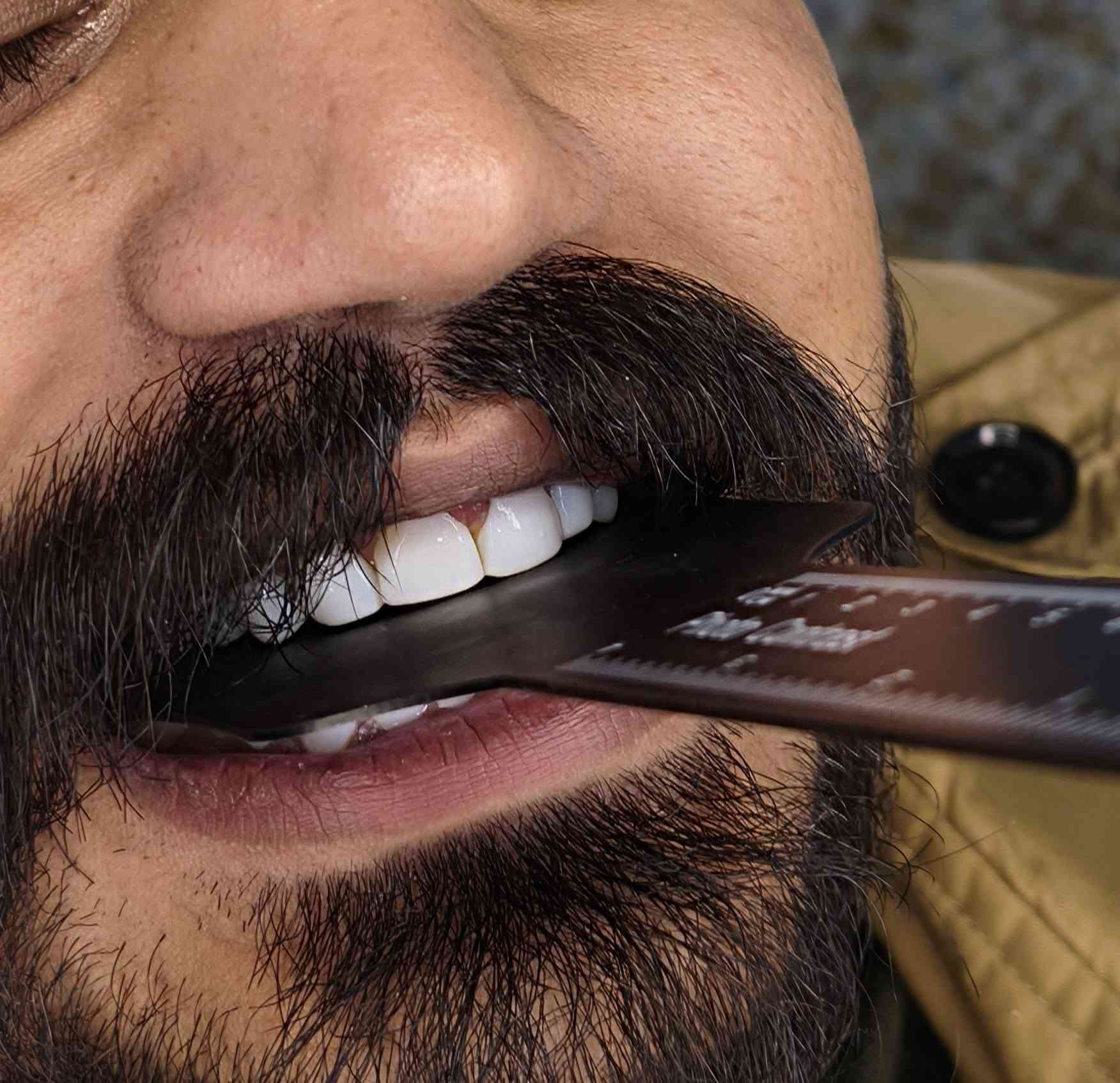 ✨ ردّة فعل المراجع بعد ابتسامته بدون برد! ✨
عيادة الدكتورة هند الحسيني 
الامين الثانيه/النواب(شارع المهداوي
للحجز والاستفسار 
***********
