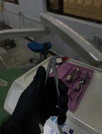 خلع سنان • علاج مجاني • جامعة واسط