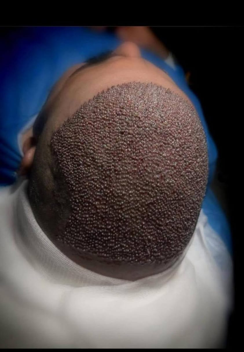 سلام علیکم.
معاکم...  محمد
مترجم طبیه وخبير في  علاج العيون وعمليات التجميل فی مشهد للإجابة عن إستفساراتكم وأسئلتكم أرجو مراسلتي عبرالخاص مع الشكر والتقدير .مع کافه الخدمات الطبیه🙏💐

*********** واتساب
