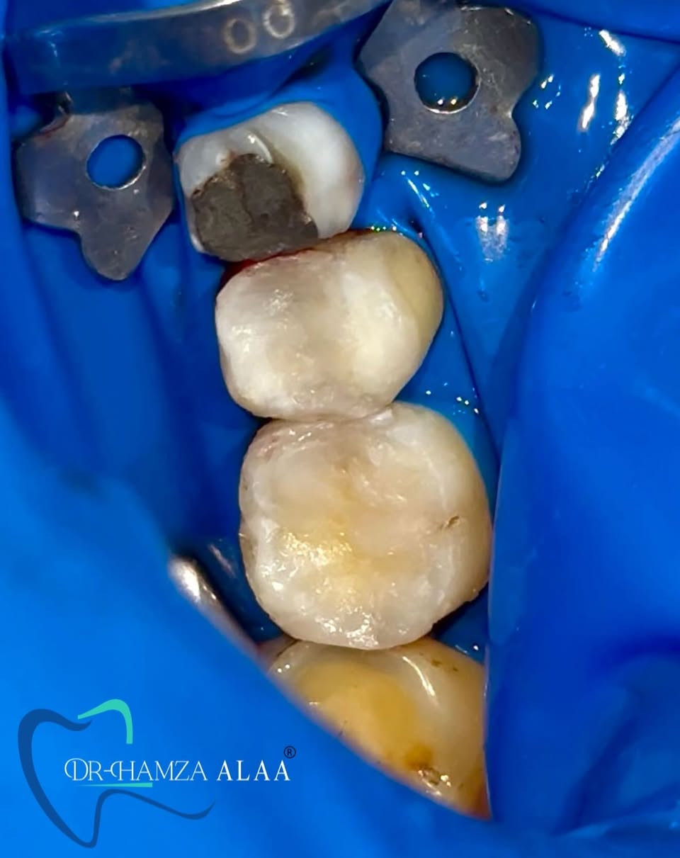 للحجز والأستفسار مراسلة الصفحة او عن طريق الواتساب *********** 
العنوان بسماية الشارع العام
