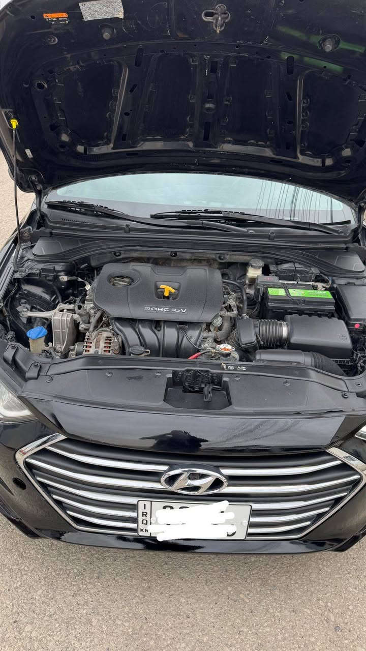 النترا 2017 سنويه وهزه ورقم جديد اربيل ضررها بونيد صبغ فقط بدون داخل بدون شاصي مكينه كير شرط لا صرف لا نفخ مكانها موصل السعر 122 بيها مجال بسيط
للتواصل *********** بي واتساب غير متواجد عالفيس
