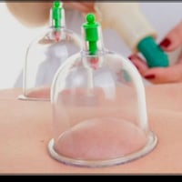 حجامة نبوية • أدوات مرة واحدة • بابل المهناويه