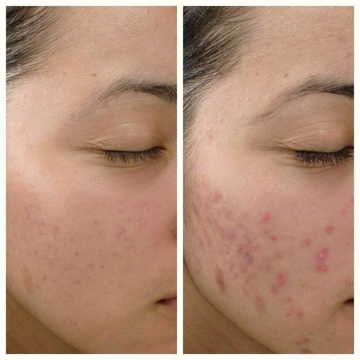 كريم تبيض نضاره للبشره
تتفتيح البشرة
حب شباب كلف نمش تصبغات
 ستخدم رجل نساء


**إذا كنت صاحب هذا الإعلان وتريد حذفه لأي سبب، رجاءا أرسل رسالة إلى الدعم الفني**