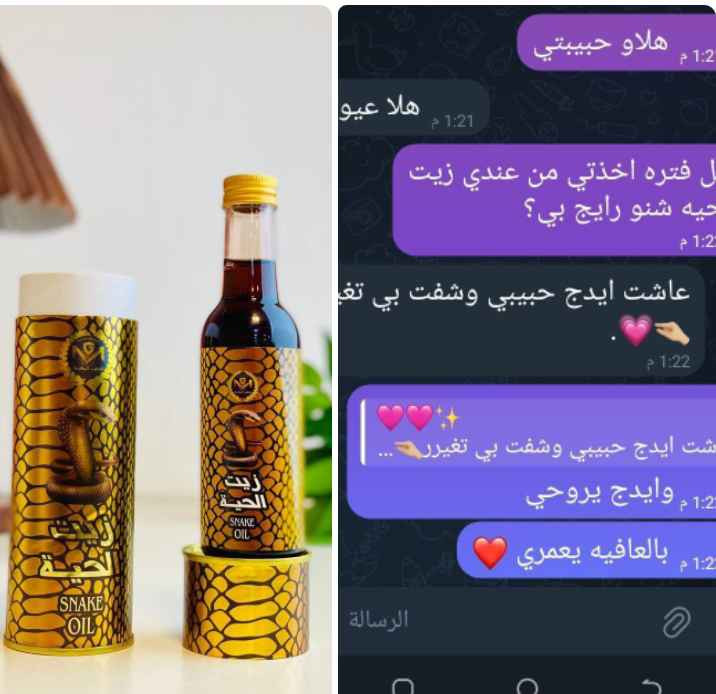 🐍 زيت الحية المغربي الاصلي MG 🐍

مكون من زيت الحيه الاصلي مضاف له
 مجموعه زيوت اصليه وفيتامينات لكي
 تزيد وتتضاعف فعاليته لعلاج جميع مشاكل الشعر
توقف التساقط باول استعمالين او 3☺️
فوائد المنتج.....
⬅️ إيقاف تساقط الشعر خلال فترة قصيرة جدا
⬅️ تقوية بصيلات الشعر من جذوره
⬅️يعطي نظارة للشعر تفوق اغلب مستحضرات التجميل
⬅️يعمل على اطالة الشعر بشكل ممتاز
⬅️ يعمل على تكثيف الشعر بفتره قصيرة جدا
*يمكن استخدامه من من قبل النساء والرجال
المنتج طبيعي ١٠٠٪؜ ومضنع وفق
 المواصفات العالميه من شركه الذهب المغربي MG

طريقة الاستخدام 😍
✅توضع على فروة الشعر ليلا مع التدليك
 لمدة ٢-٣دقائق وتغسل في الصباح

السعر :: 15 الف وتوصيل مجاني بغداد, العراق


**إذا كنت صاحب هذا الإعلان وتريد حذفه لأي سبب، رجاءا أرسل رسالة إلى الدعم الفني**