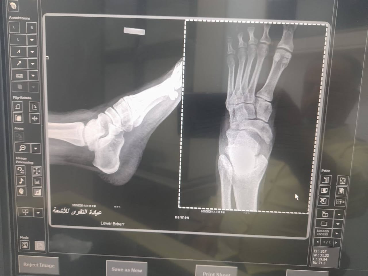 السلام عليكم 
عيادة التقوى للفحص بالاشعه لجميع انواع الكسور والاصابات الرياضيه والمفاصل ولكل اجزاء الجسم الملونه والعاديه 
جهاز CR ,,الحديث 
العنوان الرمادي  ٥كيلو مقابل جامع الشهداء
للاستفسار على الرقم ***********
واتس اب واتصال 
الصحه والسلامه للجميع يارب
