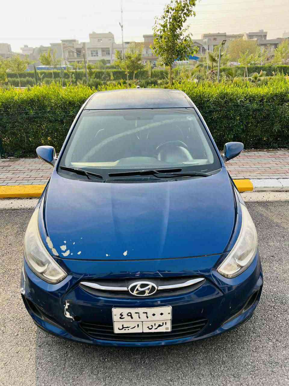 accent 2017  
‎             ( سعری : 85 وەرەقە مەجال )
‎ئەکسێنت 
‎مۆدیل : 2017
‎٢ ملیۆن و ٥٧٠ هەزار غرامەی لەسەرە 
‎4 پارچەی سوخە 
‎پێشی کەپسە ، پشتی جەمپەکی زۆر خەفیفی هەیە 
‎گێرو مەکینەی بەشەرتە 
‎شوێن هەولێر 
‎ڕەقەم تەلەفۆن : *********** أربيل, العراق
