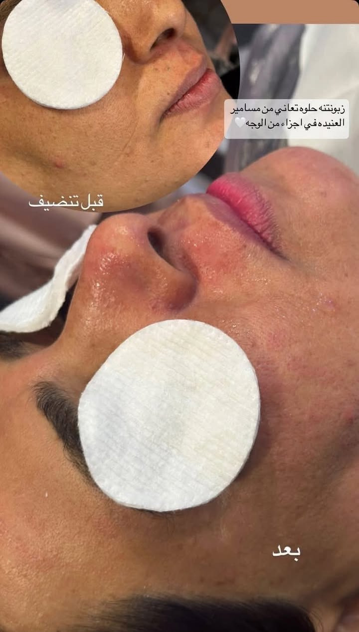 اشتغل بالبيت الفرع المقابيل أفران التاج بفرع أسواق السلام كوافيرا جوكر شامله اكعد حتى ايام العيد الحفافة مع تنظيف البشرة بجهاز الهايدوفشل والبخار والماسكات بسعر 10 فقط بدون تنظيف بشرة 5 

صبغ الشعر من 15 إلى 30 
تسريح الشعر عليه عرض


**إذا كنت صاحب هذا الإعلان وتريد حذفه لأي سبب، رجاءا أرسل رسالة إلى الدعم الفني**