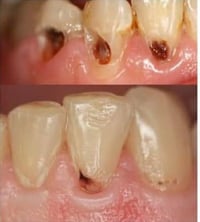 مجاناً اي شخص يعاني من هذي الحاله  العمل مجاني بالكامل وتحت اشراف أطبا...