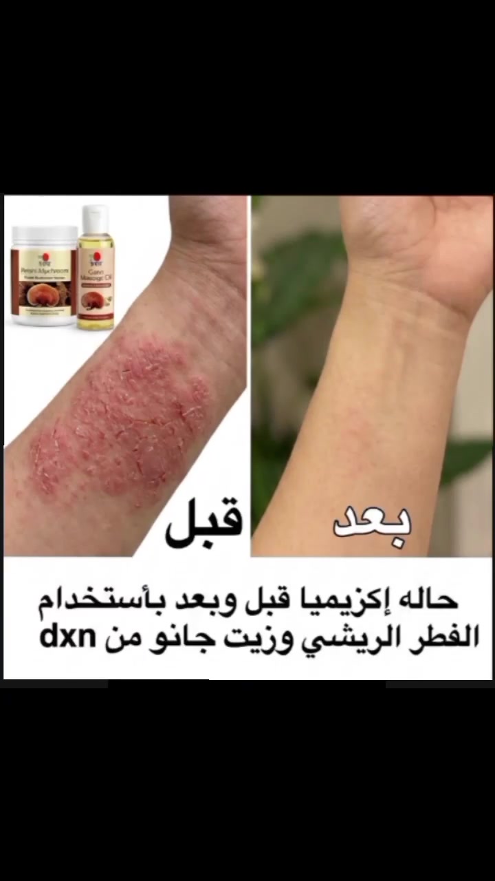 سر نجاحنا واستمرارنا ليس في البيع لأول مرة، بل في ثقة عملائنا الذين يعودون للشراء مراراً وتكراراً بعد أن يلمسوا النتائج العالمية بأنفسهم. جرّب المنتج اليوم، وتأكد أنك ستكون العميل الدائم القادم!"


**إذا كنت صاحب هذا الإعلان وتريد حذفه لأي سبب، رجاءا أرسل رسالة إلى الدعم الفني**