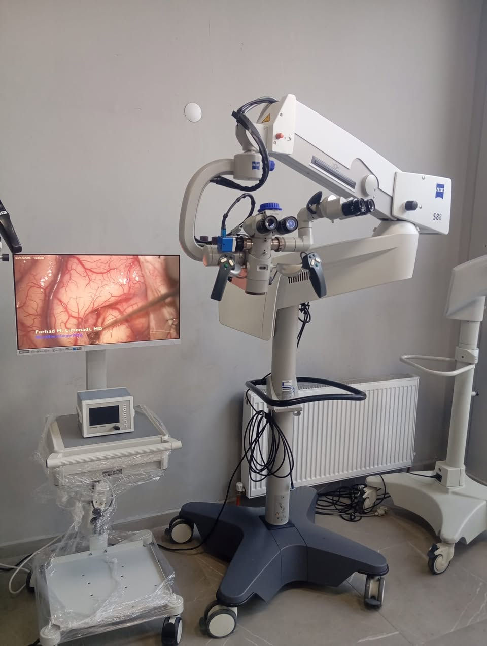 🔬 ZEISS OPMI Vario S88 | 2019 — Available Now

One scope. Every specialty.

Built for neurosurgery, spine, ENT & plastic surgery — the ZEISS OPMI Vario S88 delivers unmatched optical precision backed by the legendary ZEISS engineering.

⚙️ What makes it exceptional:

✔️ Apochromatic optics — stunning clarity & true color

✔️ 1:6 motorized zoom — instant, hands-free control

✔️ Varioscope internal focus — no lens swaps needed

✔️ 180W Xenon illumination — deep, shadow-free light

✔️ Electromagnetic braking — effortless yet rock-steady

✔️ S88 stand — magnetic locking joints, wide range of motion

✔️ HD video compatible — teach, record, document

📐 Working Distance: 200–415 mm

🔭 Zoom: 1:6 | Eyepieces: 10x / 12.5x

📹 Full documentation & co-observation ready

📩 DM us for price & availability.

We ship regionally. Fast response guaranteed.


**إذا كنت صاحب هذا الإعلان وتريد حذفه لأي سبب، رجاءا أرسل رسالة إلى الدعم الفني**