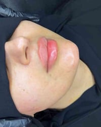 مركز اوتار كلنك • طب الأسنان • تجميل