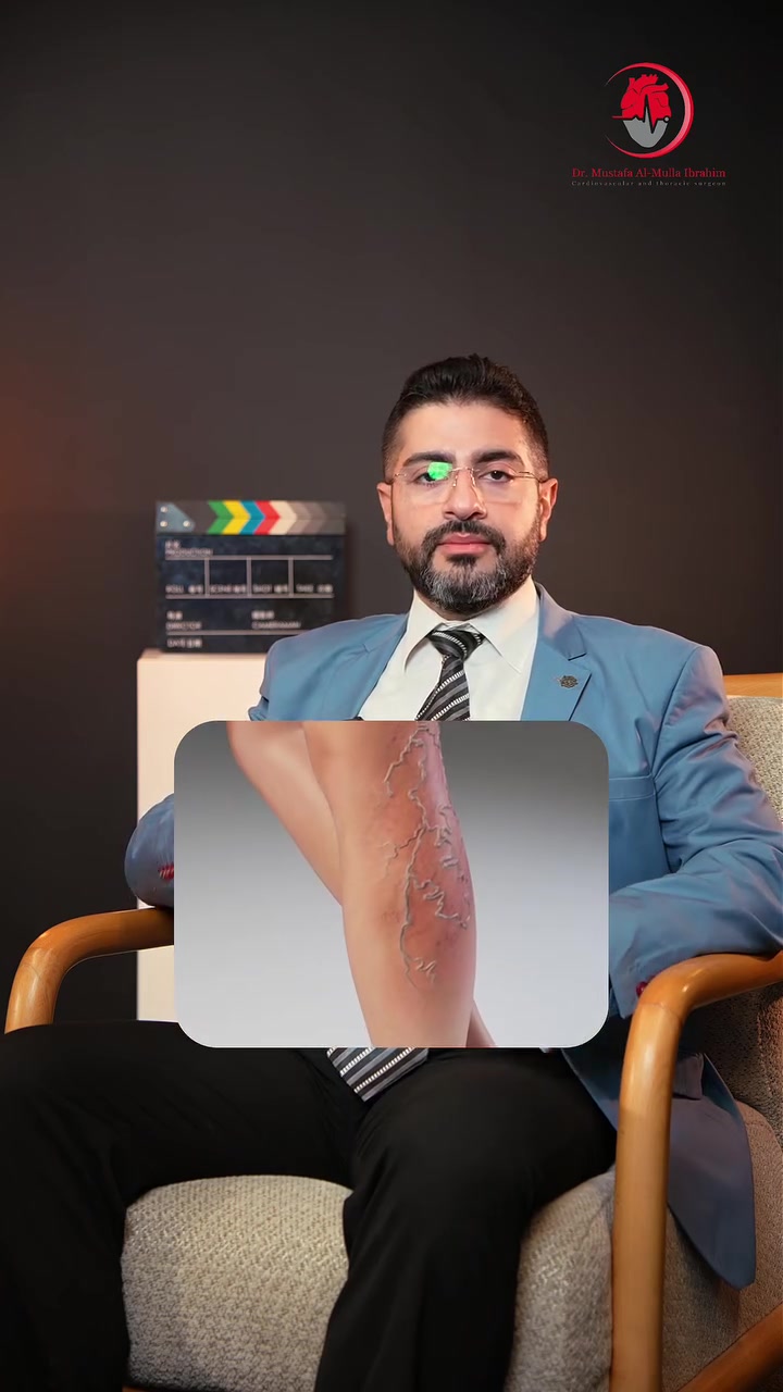 الحقن التصلبية 

صحتك ما تقبل المجازفة 
 الدكتور مصطفى الملا ابراهيم
دكتوراه بورد جراحة القلب والصدر و الاوعية الدموية 
 حاصل على التخصص الدقيق في التداخل القسطاري و الجراحة للأوعية الدموية للاطراف

📍 العنوان: بغداد – الكرادة
شارع سلمان فائق
مجمع العذراء الطبي – مجاور صيدلية مسك بغداد ومختبر ناسا

📞 للحجز والاستفسار:***********
