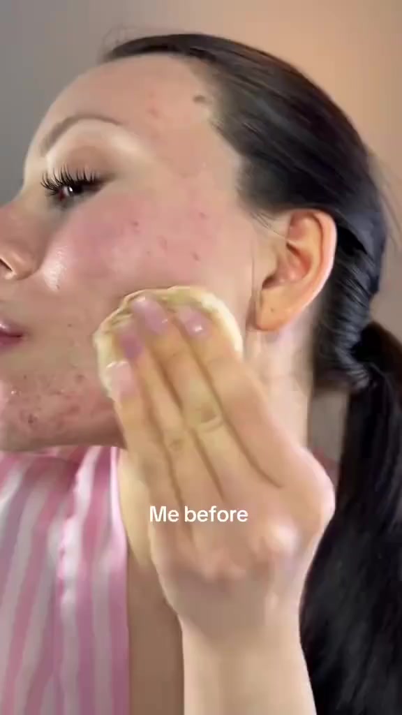 � غسول ريفولي – بتركيبة الساليسيليك أسيد
تنظيف عميق لبشرة خالية من الحبوب والدهون الزائدة ✨

🔹 ينظف المسام بعمق
🔹 يزيل الخلايا الميتة بلطف
🔹 يقلل الرؤوس السوداء والحبوب
🔹 يوازن إفراز الدهون بدون تجفيف
🔹 مناسب للبشرة الدهنية والمختلطة

📌 طريقة الاستخدام:
استخدميه على بشرة مبللة مرة أو مرتين باليوم، ودلكي بلطف ثم اشطفي بماء فاتر.

💬 النتيجة؟ بشرة صافية، ناعمة، وأنقى يوم بعد يوم 💙


**إذا كنت صاحب هذا الإعلان وتريد حذفه لأي سبب، رجاءا أرسل رسالة إلى الدعم الفني**