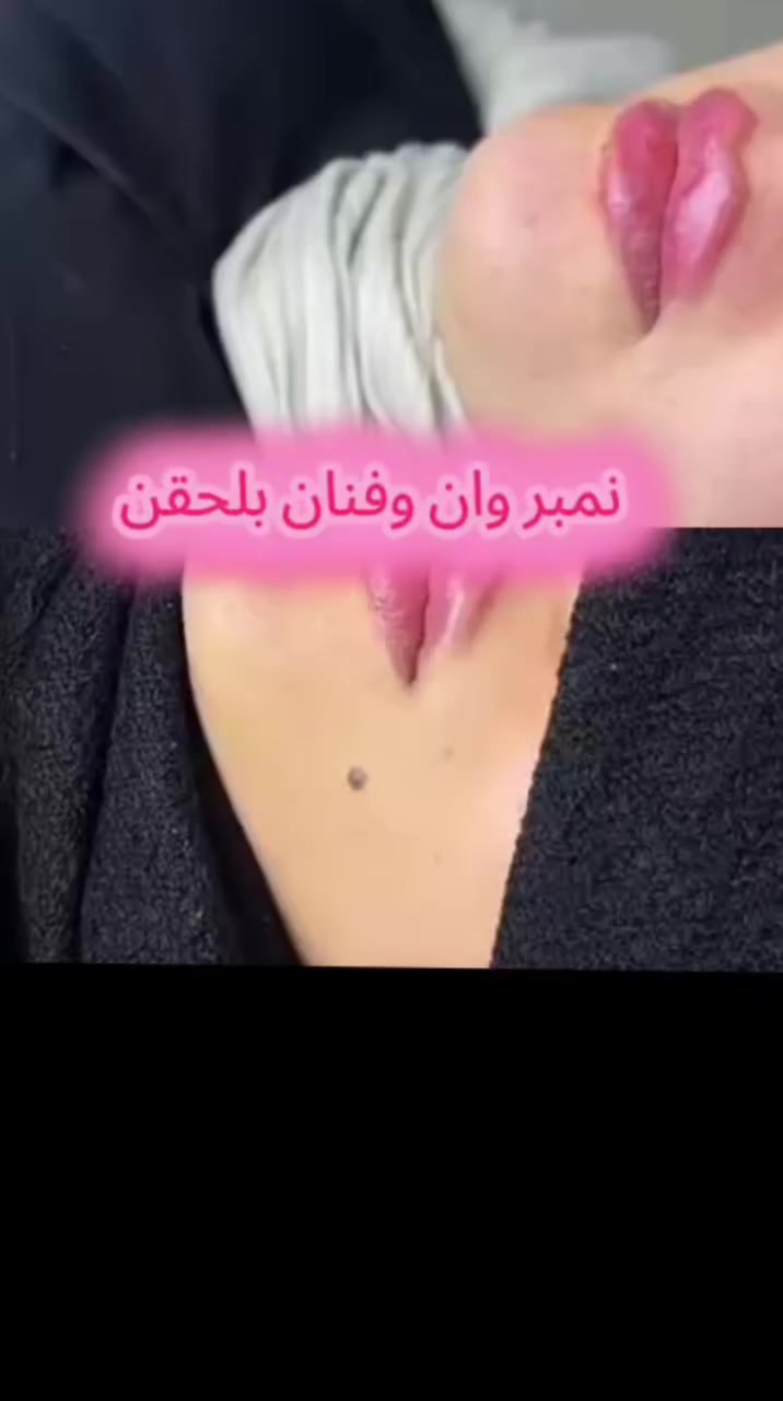 جميع الخدمات في قسم الحقن تعتمد على مواد أصلية ومرخّصة، ولا يتم استخدام أي مواد غير معتمدة أو مخالفة
لاهم المصداقيه وصحتكم  بكلشي
مراجعينه الحلوين
للحجز والاستفسار 
المحموديه حي ربيعي قرب مرطبات البركه
0776 874 7627
