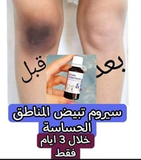 أصلي فرنسي • تبييض المناطق الحساسة • يقشر بعد ٤ أيام