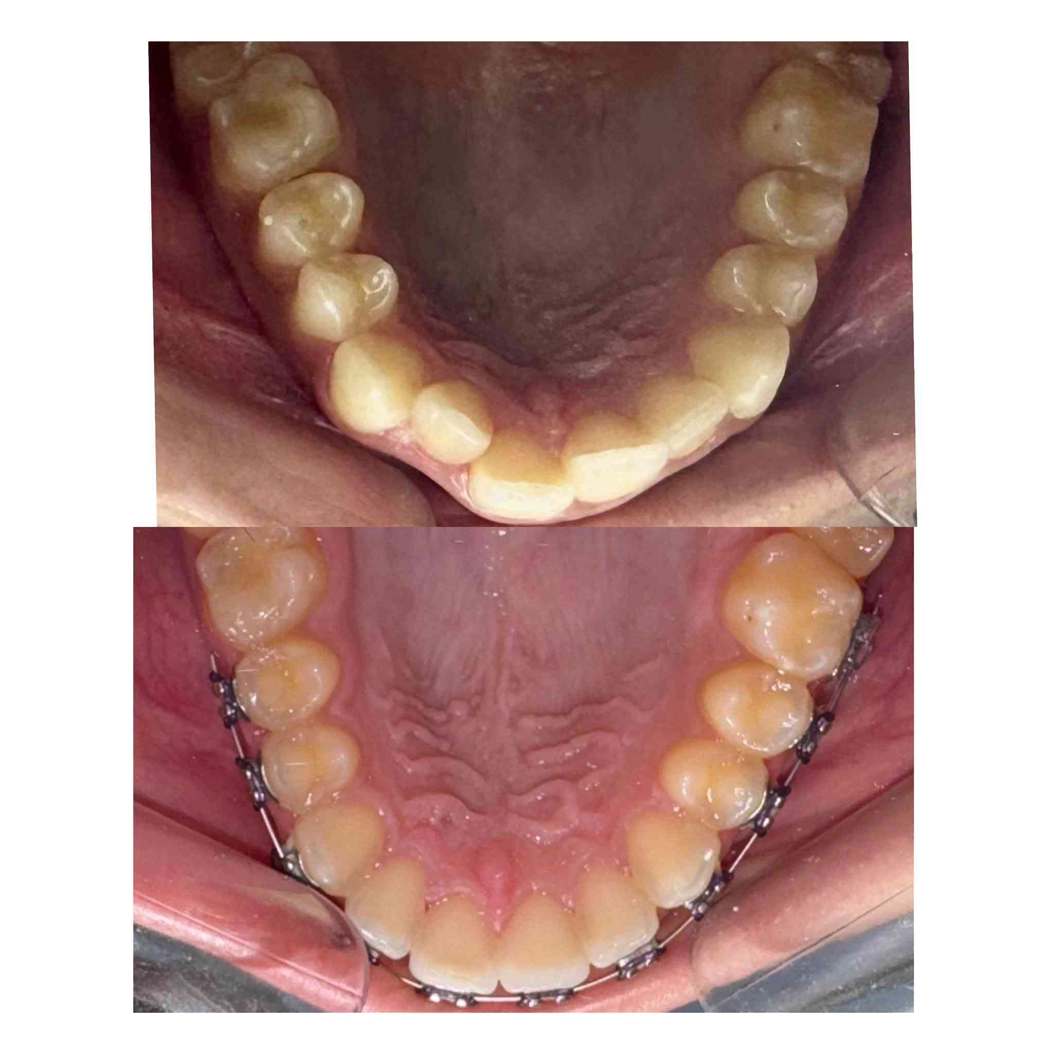 مرحبا بنوتات  شلونكم
وياكم د.شهدسعدي اخصائيه تقويم و سرتفكيت تجميل اسنان متواجدة بعيادة عياده الرحيق لطب وتجميل الاسنان قرب سوق علي نعمة السبت الاثنين الاربعاء صارلنا خمس سنوات والحمدلله مراجعينا يعرفون شون شغلنا نظيف و علمي و ننصح بالشي الزين و اسعارنا مناسبه 
رح اخليلكم صور من شغلي و اي استفسار عدكم تكدرون تتواصلون ويانه على الرقم *********** 
وهذا حسابي على الانستا 
https://www.instagram.com/drshahadsaadi618?igsh=Mjhkemhnbzdld3R5&utm_source=qr
