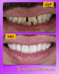 عيادة أسنان • زراعة أسنان • البصرة المطيحة